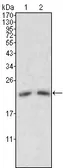 Anti-Apolipoprotein M antibody [8F12C6B8] used in Western Blot (WB). GTX83083