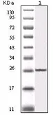 Anti-IKK beta antibody [10A2C5B3] used in Western Blot (WB). GTX83085