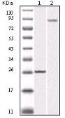 Anti-IKK beta antibody [10A2] used in Western Blot (WB). GTX83086