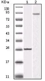 Anti-IKK beta antibody [10A2] used in Western Blot (WB). GTX83086