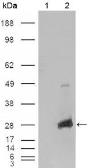 Anti-alpha B Crystallin antibody [1D11C6E6] used in Western Blot (WB). GTX83088
