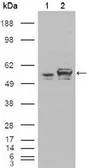 Anti-Calreticulin antibody [1G6A7] used in Western Blot (WB). GTX83089