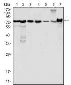 Anti-LPP antibody [8B3A11] used in Western Blot (WB). GTX83092