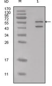 Anti-Calreticulin antibody used in Western Blot (WB). GTX83093