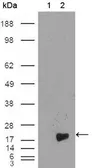 Anti-Survivin antibody [2H5H2] used in Western Blot (WB). GTX83094