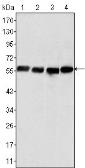 Anti-Vimentin antibody [4F2E9] used in Western Blot (WB). GTX83095