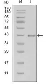 Anti-Laminin beta 1 antibody [2D9G5] used in Western Blot (WB). GTX83109