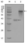 Anti-Cytokeratin 19 antibody [9H8G6] used in Western Blot (WB). GTX83113