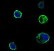 Anti-MUSK antibody [10A4] used in Immunocytochemistry/ Immunofluorescence (ICC/IF). GTX83118