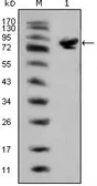 Anti-Islet 1 antibody [1H9] used in Western Blot (WB). GTX83121