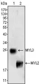 Anti-Myosin Light Chain 3 antibody [3F8] used in Western Blot (WB). GTX83123