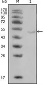 Anti-LPL antibody [2C5] used in Western Blot (WB). GTX83126