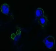Anti-FGFR4 antibody [7H1] used in Immunocytochemistry/ Immunofluorescence (ICC/IF). GTX83129
