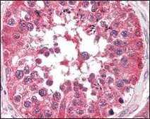 Anti-B-Raf antibody [1H12] used in IHC (Paraffin sections) (IHC-P). GTX83134