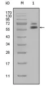 Anti-Cytokeratin 5 antibody [1E1] used in Western Blot (WB). GTX83135