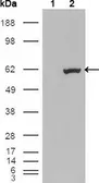 Anti-ER81 antibody [1C8B6] used in Western Blot (WB). GTX83139