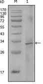 Anti-Factor VIII antibody [5E9B2] used in Western Blot (WB). GTX83141