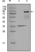 Anti-EphA7 antibody [6C8G7] used in Western Blot (WB). GTX83143