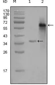 Anti-SRC3 antibody [2C11B12] used in Western Blot (WB). GTX83144