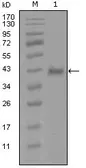Anti-Androgen Receptor antibody [1A9D12] used in Western Blot (WB). GTX83145