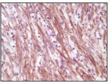 Anti-Desmin antibody [10H7D2] used in IHC (Paraffin sections) (IHC-P). GTX83146