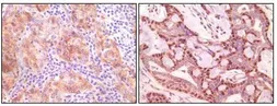 Anti-gamma Synuclein antibody [1H10D2] used in IHC (Paraffin sections) (IHC-P). GTX83156