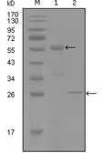 Anti-Progesterone Receptor antibody [8A11H1] used in Western Blot (WB). GTX83165