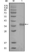 Anti-NCOR1 antibody [7A7A9] used in Western Blot (WB). GTX83168
