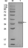 Anti-NCOR1 antibody [7A7A9] used in Western Blot (WB). GTX83168