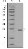 Anti-AXL antibody [1B3A2] used in Western Blot (WB). GTX83181