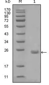 Anti-AXL antibody [1B3A2] used in Western Blot (WB). GTX83181