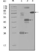 Anti-MAP4K4 antibody [3C7B5] used in Western Blot (WB). GTX83189