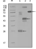 Anti-MAP4K4 antibody [3C7B5] used in Western Blot (WB). GTX83189