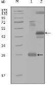 Anti-MAP4K4 antibody [4H9E7] used in Western Blot (WB). GTX83190