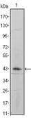 Anti-Integrin alpha 5 antibody [10F6] used in Western Blot (WB). GTX83192