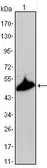 Anti-Cytokeratin 15 antibody [6E7] used in Western Blot (WB). GTX83193