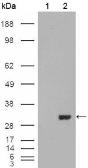 Anti-Carbonic Anhydrase 1 antibody [9D6D7] used in Western Blot (WB). GTX83196