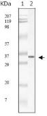 Anti-SARS-CoV M antibody [2H2C4] used in Western Blot (WB). GTX83199