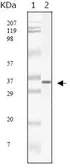 Anti-SARS-CoV M antibody [2H2C4] used in Western Blot (WB). GTX83199