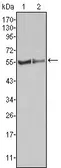 Anti-FGR antibody [6G2] used in Western Blot (WB). GTX83208