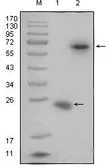 Anti-RSPO1 antibody [7A6] used in Western Blot (WB). GTX83211