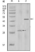 Anti-IL2 antibody [8D5] used in Western Blot (WB). GTX83212