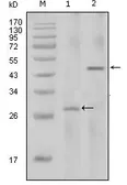 Anti-IL2 antibody [8D5] used in Western Blot (WB). GTX83212