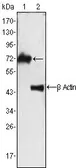 Anti-ZAP70 antibody [3D2A4] used in Western Blot (WB). GTX83218