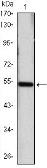 Anti-Shh antibody [8G3] used in Western Blot (WB). GTX83231