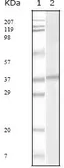 Anti-KSHV ORF62 antibody [5B7B6] used in Western Blot (WB). GTX83235