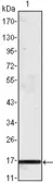 Anti-MCP1 / CCL2 antibody [1A7B8] used in Western Blot (WB). GTX83238