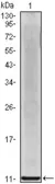 Anti-CXCL8 / IL8 antibody [3E4D8] used in Western Blot (WB). GTX83239