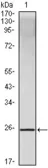 Anti-IL10 antibody [3C12C12] used in Western Blot (WB). GTX83241