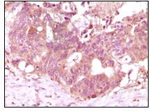 Anti-FGF2 antibody [2H5G2C11] used in IHC (Paraffin sections) (IHC-P). GTX83243